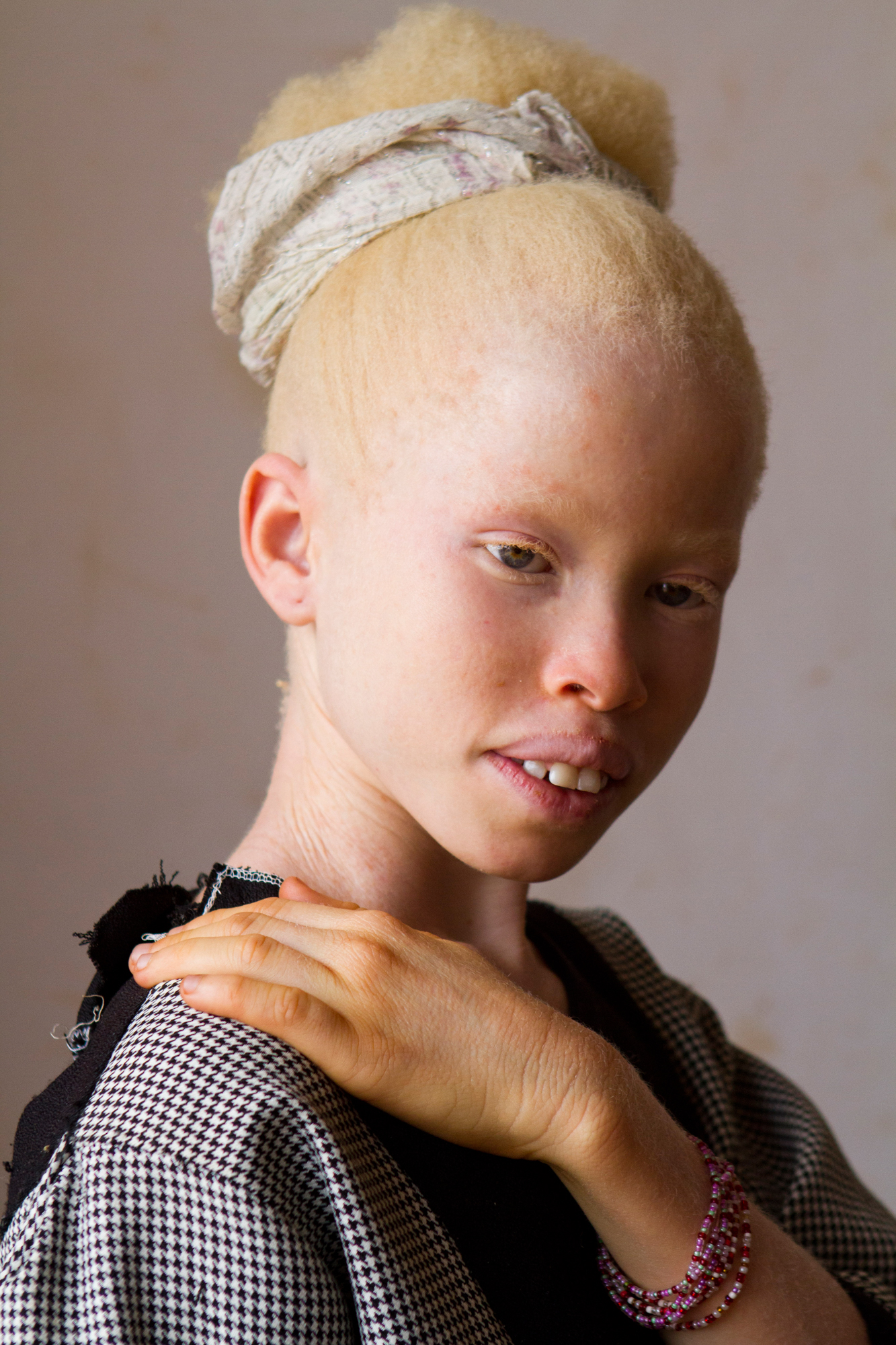 rencontre femme albinos)